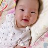 Mắt híp